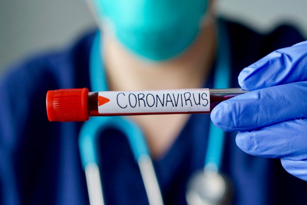 Formation-et-coronavirus